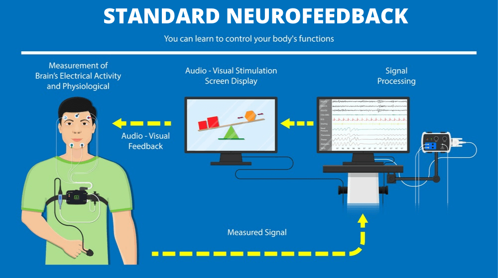 Standard Neurofeedback